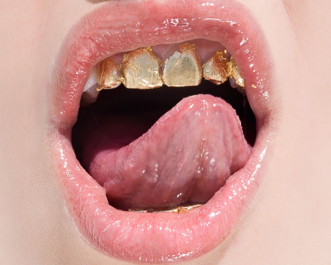 Golden teeth by Sylvie Blum, closeup of open mouth with goldplated teeth